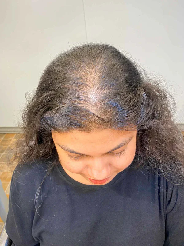 2 Clip Volume Boosting Topper | 100% Human Hairs | 6 Months Hair Warranty