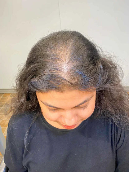 2 Clip Volume Boosting Topper | 100% Human Hairs | 6 Months Hair Warranty